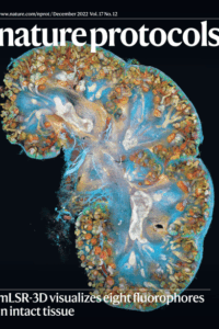 Multispectral confocal 3D imaging of intact healthy and tumor tissue using mLSR-3D 1